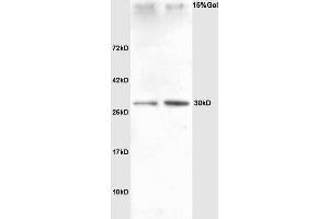 Lane 1: rat heart Lane 2: rat liver lysates probed with Anti SNAI2/SLUG Polyclonal Antibody, Unconjugated (ABIN685747) at 1:200 in 4 °C. (SLUG 抗体  (AA 5-120))