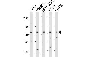 All lanes : Anti-NLRP6 Antibody (N-term) at 1:2000 dilution Lane 1: Jurkat whole cell lysate Lane 2: U266B1 whole cell lysate Lane 3: RI 8226 whole cell lysate Lane 4: HT-29 whole cell lysate Lane 5: S whole cell lysate Lysates/proteins at 20 μg per lane. (NLRP6 抗体  (N-Term))