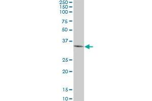 DKK1 monoclonal antibody (M01), clone 4D4. (DKK1 抗体  (AA 81-180))
