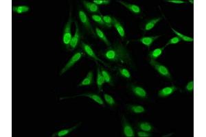 Immunofluorescence (IF) image for anti-Melanoma Antigen Family D, 2 (MAGED2) (AA 38-285) antibody (ABIN7159296)