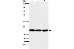 Western blot analysis of p53 DINP1 expression in (1) HepG2 cell lysate, (2) RAW 264.