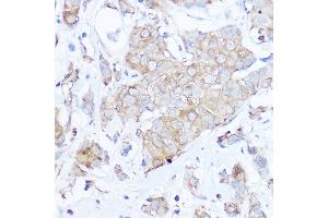 Immunohistochemistry (IHC) image for anti-Matrix Gla Protein (MGP) (AA 20-103) antibody (ABIN6143825)