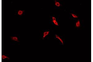 ABIN6269213 staining A549 cells by IF/ICC. (CDC25B 抗体  (Internal Region))