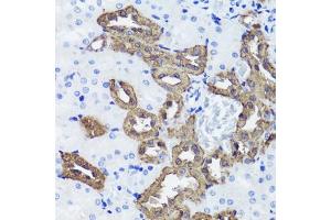 Immunohistochemistry of paraffin-embedded rat kidney using Calbindin antibody (ABIN6134603, ABIN6137847, ABIN6137848 and ABIN6213988) at dilution of 1:100 (40x lens). (CALB1 抗体  (AA 1-261))