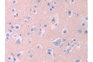 Immunohistochemistry (IHC) image for anti-Lecithin-Cholesterol Acyltransferase (LCAT) (AA 290-433) antibody (ABIN7436690)