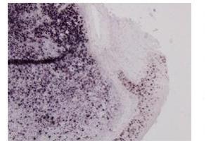 Sample Type:  Human Tonsil TissuePrimary   Dilution:  1ug/mL (MSH6 抗体  (N-Term))