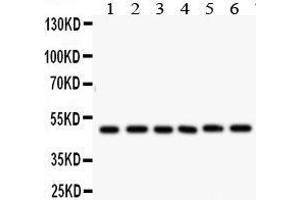 Lane 5: PANC Whole Cell Lysate at 40ug Lane 6: HEPG2 Whole Cell Lysate at 40ug Predicted bind size: 48KD Observed bind size: 48KD (IKBKG 抗体  (N-Term))