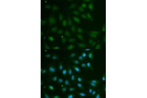 Immunofluorescence analysis of MCF-7 cells using ABO antibody (ABIN5970766). (ABO 抗体)