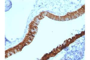 Formalin-fixed, paraffin-embedded human Ovary stained with Cytokeratin 3 Mouse Monoclonal Antibody (KRT3/2130). (Keratin 3 抗体)