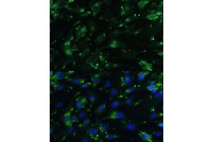 Immunofluorescence analysis of C6 cells using CGRP antibody (ABIN6128310, ABIN6137852, ABIN6137855 and ABIN6221187) at dilution of 1:100. (CGRP 抗体  (AA 1-141))