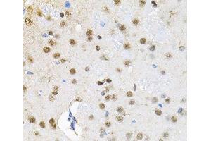 Immunohistochemistry of paraffin-embedded Rat brain using BAF60a Polyclonal Antibody at dilution of 1:100 (40x lens). (SMARCD1 抗体)