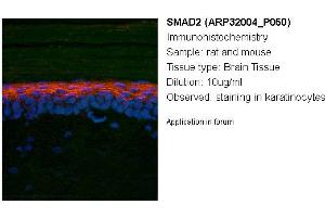 Image no. 2 for anti-SMAD, Mothers Against DPP Homolog 2 (SMAD2) (N-Term) antibody (ABIN2779412)