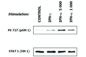 Induction of phosphorylation of STAT1 (Western Blotting) Fig. (STAT1 抗体)