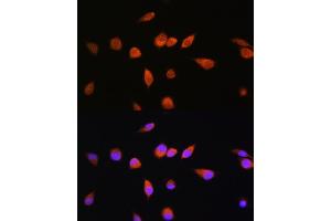 Immunofluorescence analysis of L929 cells using R Rabbit pAb (ABIN7269800) at dilution of 1:100. (RAB20 抗体  (AA 80-190))