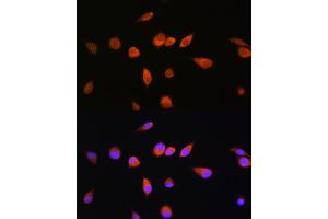 Immunofluorescence analysis of L929 cells using R Rabbit pAb (ABIN7269800) at dilution of 1:100.