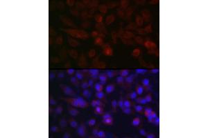 Immunofluorescence analysis of HeLa cells using AURKA Rabbit pAb (ABIN3022969, ABIN3022970, ABIN3022971 and ABIN6219323) at dilution of 1:100 (40x lens). (Aurora A 抗体  (AA 1-100))