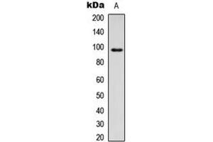 Western blot analysis of CD18 expression in HEK293T (A) whole cell lysates. (Integrin beta 2 抗体  (Center))
