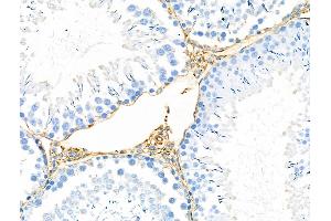 ABIN6259135 and ABIN6275366 at 1/100 staining Rat testis tissue by IHC-P. (nectin-3 抗体  (Internal Region))