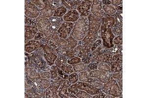 Immunohistochemical staining of human kidney with TRIM7 polyclonal antibody  shows strong cytoplasmic positivity in tubular cells at 1:200-1:500 dilution. (TRIM7 抗体)