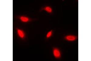 Immunofluorescent analysis of ANAPC1 staining in HeLa cells. (APC1 抗体  (Center))
