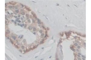 Immunohistochemistry (IHC) image for anti-ATP Synthase, H+ Transporting, Mitochondrial F0 Complex, Subunit F6 (ATP5J) (AA 1-108) antibody (ABIN7441733)