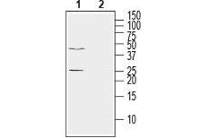 Western blot analysis of human LNCaP prostate adenocarcinoma cell line lysate: - 1. (Ephrin A5 抗体  (Extracellular))