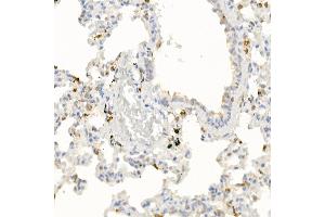 Immunohistochemistry (IHC) image for anti-Interleukin 21 (IL21) (AA 25-162) antibody (ABIN6142359)