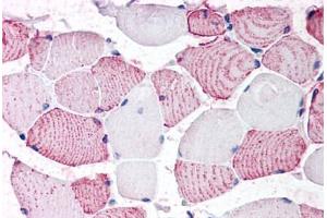 Anti-GPRC6A antibody  ABIN1048922 IHC staining of human skeletal muscle. (GPRC6A 抗体  (N-Term))