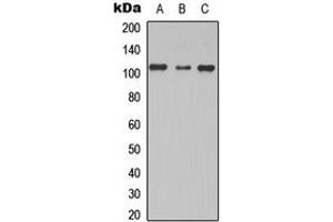 Western blot analysis of TBC1D2 expression in MCF7 (A), NS-1 (B), PC12 (C) whole cell lysates.