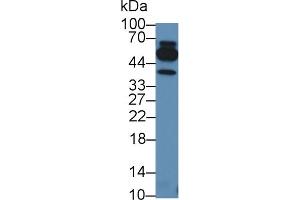 Detection of TNFb in Human Leukocyte lysate using Polyclonal Antibody to Tumor Necrosis Factor Beta (TNFb) (LTA 抗体  (AA 49-202))