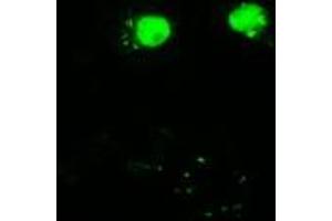 Immunofluorescence (IF) image for anti-V-Akt Murine Thymoma Viral Oncogene Homolog 3 (Protein Kinase B, Gamma) (AKT3) antibody (ABIN2715859)