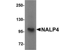Western blot analysis of NALP4 in K562 cell lysate with NALP4 antibody at 1 μg/ml. (NLRP4 抗体  (Center))