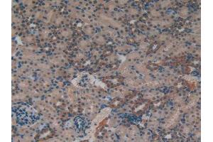 IHC-P analysis of Rat Kidney Tissue, with DAB staining. (MT-ND5 抗体  (AA 425-562))