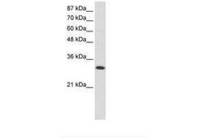 Image no. 1 for anti-AIMP1 / EMAP II (AA 31-80) antibody (ABIN6736246) (AIMP1 / EMAP II (AA 31-80) 抗体)