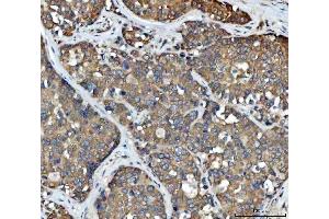 IHC analysis of FADS1 using anti-FADS1 antibody (ABIN7599175). (FADS1 抗体  (AA 1-257))