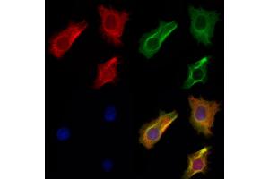 ABIN6263924 and ABIN6272926 staining Hela cells by IF/ICC. (OXCT1 抗体  (Internal Region))