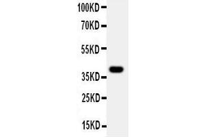 Western Blotting (WB) image for anti-Mucosal Vascular Addressin Cell Adhesion Molecule 1 (MADCAM1) (AA 173-190), (Middle Region) antibody (ABIN3044076)