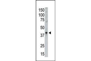 The anti-GEA9 Ctr Antibody (ABIN390111 and ABIN2840622) is used in Western blot to detect GEA9 in Placenta lysate. (MAGEA9 抗体  (AA 171-198))