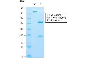 SDS-PAGE Analysis of Purified Cytokeratin 10 Rabbit Recombinant Monoclonal Antibody (KRT10/1990R). (Recombinant Keratin 10 抗体)