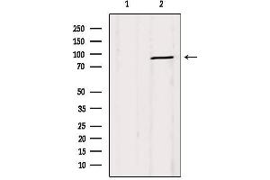 Western blot analysis of extracts from Mouse lung, using DRP1  Antibody. (Dynamin 1-Like 抗体  (C-Term))