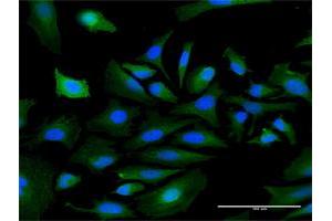 Immunofluorescence of purified MaxPab antibody to PKNOX1 on HeLa cell. (PKNOX1 抗体  (AA 1-436))