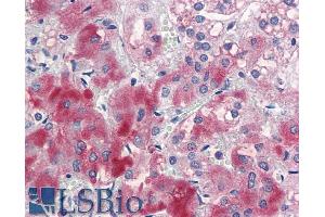 Immunohistochemistry (IHC) image for anti-Ectodermal-Neural Cortex 1 (With BTB-Like Domain) (ENC1) (Internal Region) antibody (ABIN5539762)