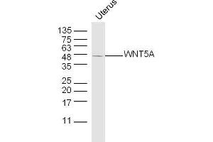 Western Blotting (WB) image for anti-Wingless-Type MMTV Integration Site Family, Member 5A (WNT5A) (AA 301-381) antibody (ABIN675758)