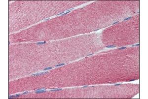 Immunohistochemistry: Human Skeletal Muscle: Formalin-Fixed, Paraffin-Embedded (FFPE). (Cell Adhesion Molecule 4 抗体  (Internal Region))