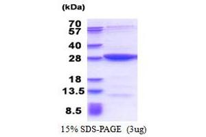 MOB Kinase Activator 3B (MOB3B) (AA 1-216) protein (His tag)