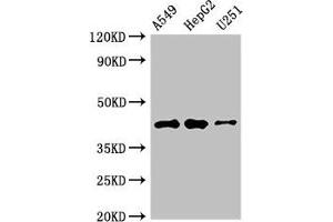 Western Blot Positive WB detected in: A549 whole cell lysate, HepG2 whole cell lysate, U251 whole cell lysate All lanes: B4GALT2 antibody at 3. (B4GALT2 抗体  (AA 271-372))