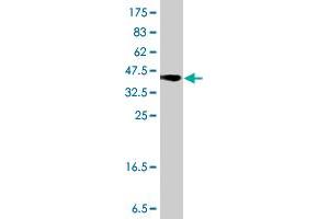 Western Blot detection against Immunogen (37.
