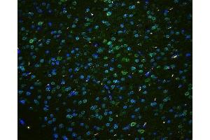 IF analysis of TPR using anti-TPR antibody (ABIN5693275) TPR was detected in paraffin-embedded section of mouse brain tissues. (TPR 抗体)