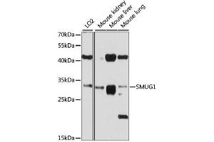 Western blot analysis of extracts of various cell lines, using SMUG1 antibody (ABIN4905242) at 1:1000 dilution. (SMUG1 抗体)