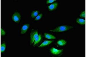 Immunofluorescent analysis of A549 cells using ABIN7153992 at dilution of 1:100 and Alexa Fluor 488-congugated AffiniPure Goat Anti-Rabbit IgG(H+L) (GRIN2C 抗体  (AA 908-1007))